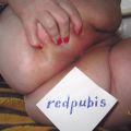 redpubis